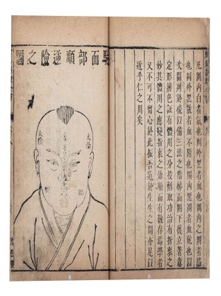 Chuang yang jing yan quan shu 瘡瘍經驗全書 [Complete Book of. Menglin 竇夢麟 DOU.