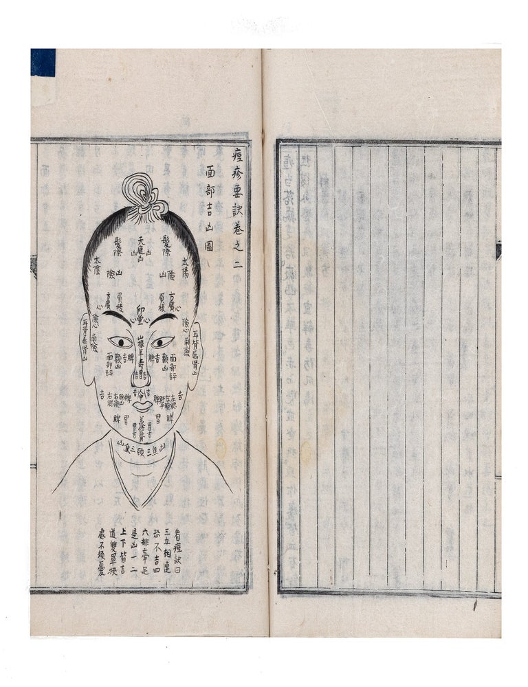 Item ID: 11584 Manuscript on paper, entitled on upper wrapper &ldquo;Tōshin yōketsu&rdquo; 痘疹要訣...