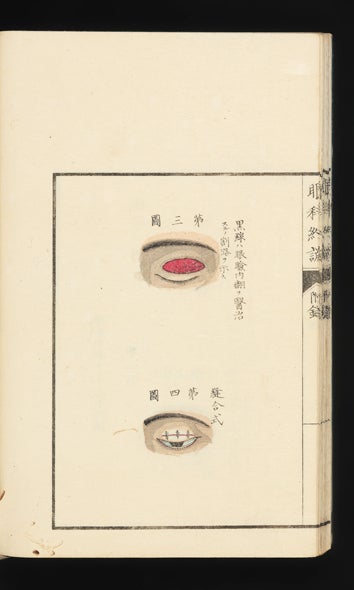 Item ID: 5002 Ganka yakusetsu [trans.: Summary of Ophthalmology]. Gen'yo OSANAI.