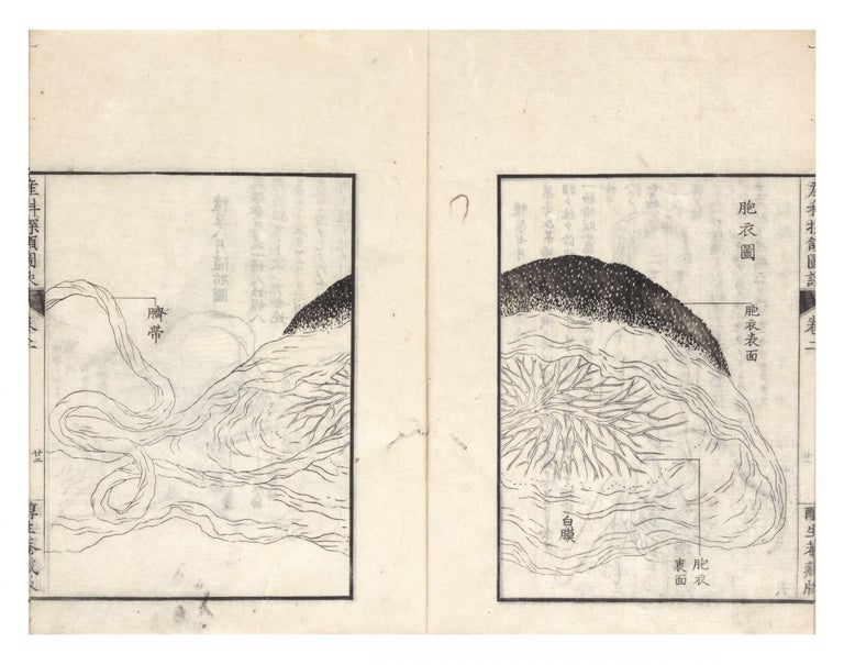 Item ID: 6692 Sanka tangan zuketsu 産科探頷圖訣 [Obstetrical Insights, Illustrated]. Sansetsu 水原濟卿 MIZUHARA.