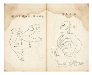 Manuscript on paper, entitled on label of upper cover, repeated on first leaf: “Kagawa kyuten zukai” [“Kagawa-style Placement of Moxa, illustrated & described. Complete”].