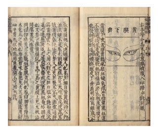 From label on upper cover]: Ginkai seibi; [from title-page]: Naifu hiden ganka ginkai seibi [in. Simiao? SUN.