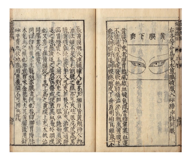 Item ID: 7013 [From label on upper cover]: Ginkai seibi; [from title-page]: Naifu hiden ganka ginkai seibi [in Chinese: Yin hai jin wei; Explanation of the Eye]. Simiao? SUN.