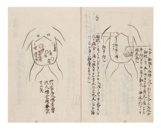 Illustrated manuscript on paper, entitled on upper wrapper “Murai sensei fukukoben” [“Abdominal Diagnosis”].