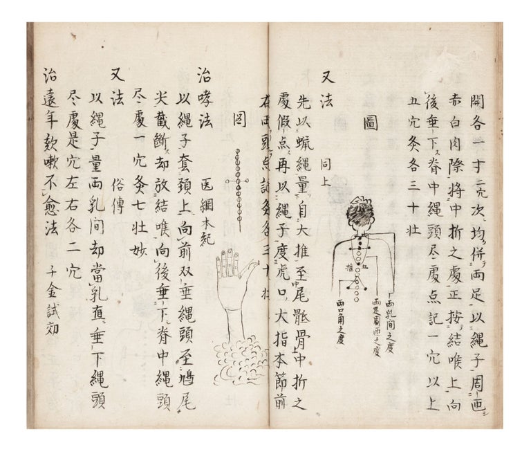 Item ID: 7072 Manuscript on paper, entitled in manuscript on title label on upper cover & on first leaf: “Kyuji hizoku den” [“Acupuncture Treatments Passed on from Many Sources”]. ACUPUNCTURE: A. COLLECTION OF TEXTS.
